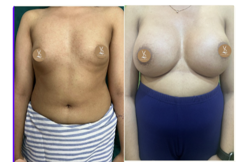 Front View · Patient 3 before and after